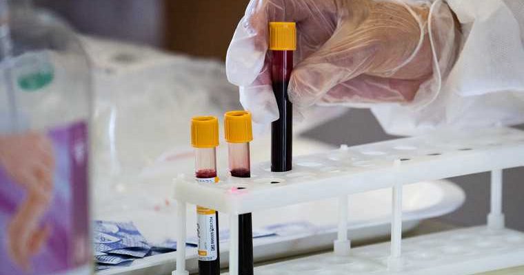 сколько человек заболело коронавирусом Тюменская область