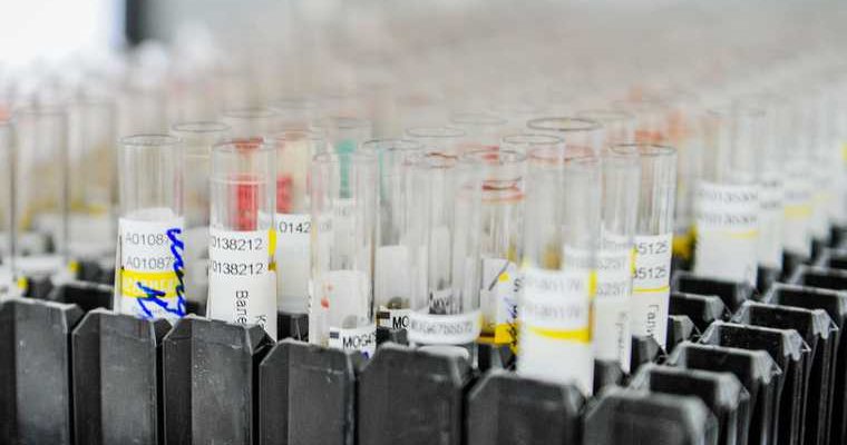 Челябинская область коронавирус тесты анализы